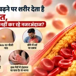कोलेस्ट्रॉल बढ़ने पर शरीर देता है ये 5 संकेत, कहीं आप भी तो नहीं कर रहे नज़रअंदाज़?
