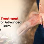Psoriasis Treatment