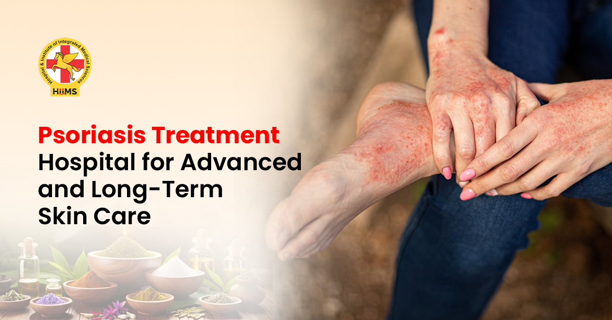 Psoriasis Treatment