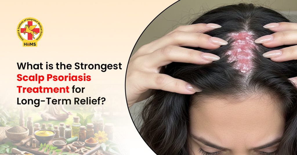 Scalp Psoriasis Treatment
