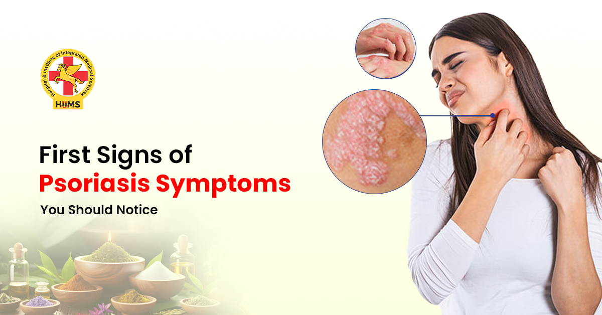 Psoriasis skin condition with inflamed, cracked patches