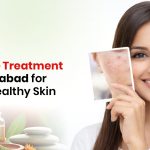 Best Acne Treatment in Ahmedabad for Clear & Healthy Skin
