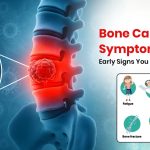 Bone Cancer Symptoms: Early Signs You Should Not Ignore
