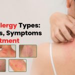 Skin Allergy Types: Causes, Symptoms & Treatment