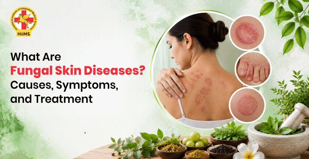 Fungal-Skin-Diseases