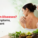 What Are Fungal Skin Diseases? Causes, Symptoms, and Treatment