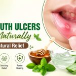 How to Cure Mouth Ulcers Fast Naturally: Causes & Natural Relief