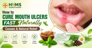 Mouth Ulcers