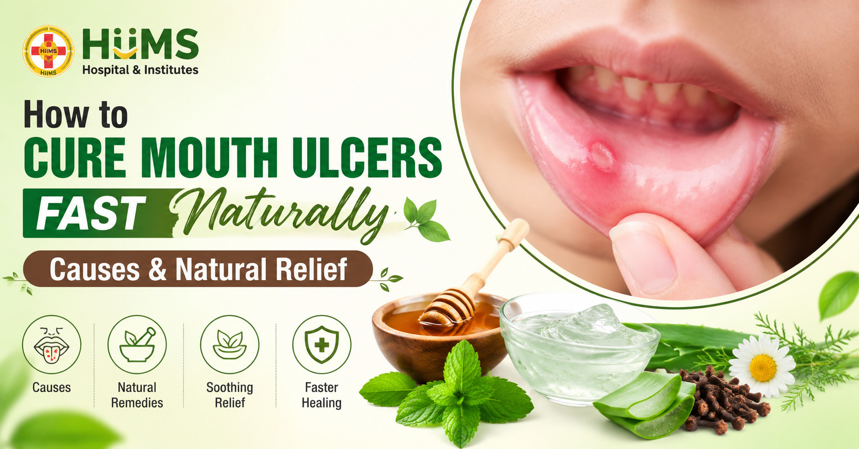 Mouth Ulcers
