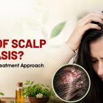 Tired of Scalp Psoriasis? Find the Right Treatment Approach