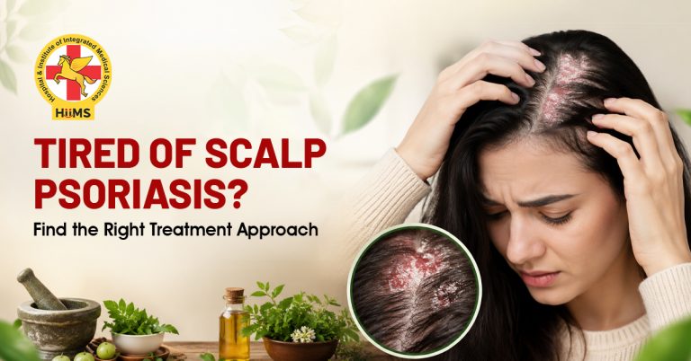 Tired of Scalp Psoriasis Find the Right Treatment Approach