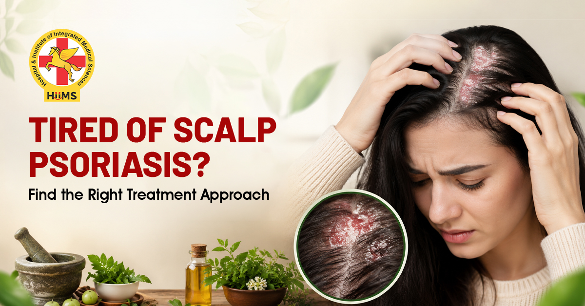 Tired of Scalp Psoriasis Find the Right Treatment Approach
