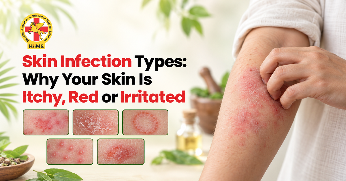Skin Infection Types: Why Your Skin Is Itchy, Red or Irritated