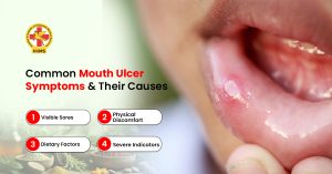 Red and white mouth ulcer on tongue with irritation