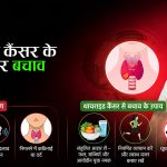 थायराइड कैंसर के लक्षण और बचाव के उपाय – पूरी जानकारी