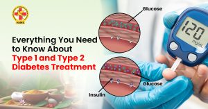 Everything You Need to Know About Type 1 and Type 2 Diabetes Treatment