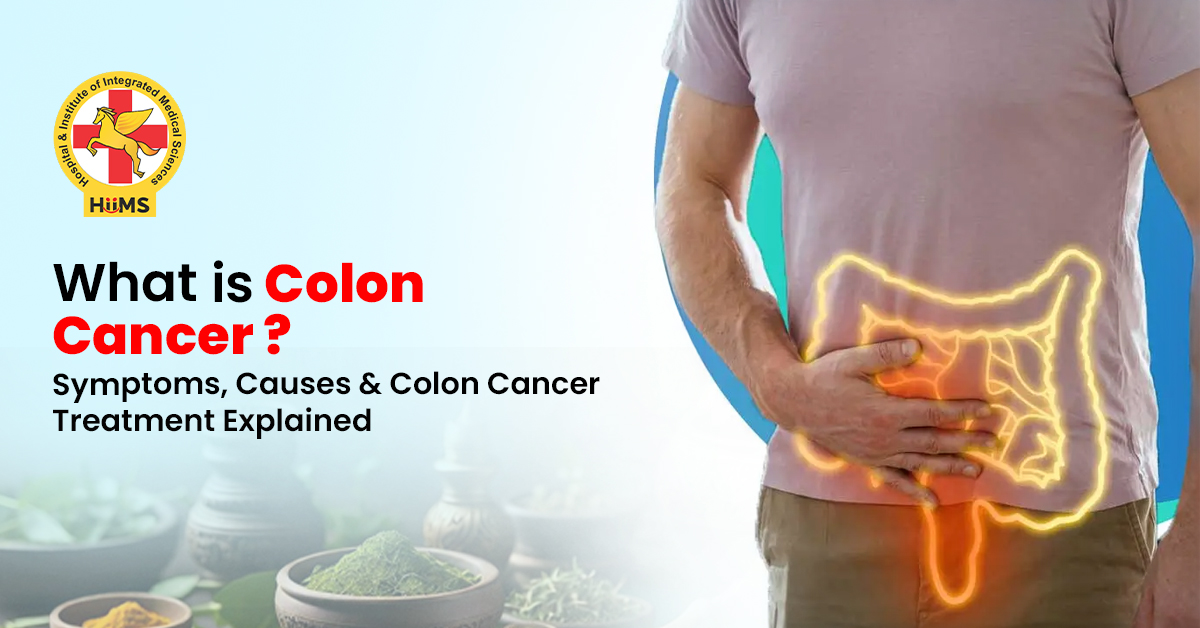 What is Colon Cancer Symptoms, Causes & Colon Cancer Treatment Explained