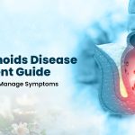 Hemorrhoids Disease Treatment Guide: Simple Ways to Manage Symptoms