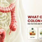 What Causes Colon Cancer? Risk Factors and Prevention Tips