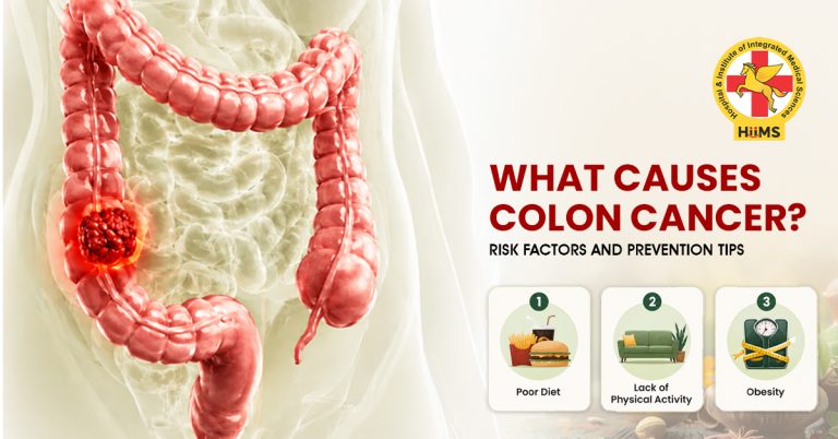 What Causes Colon Cancer Risk Factors and Prevention Tips