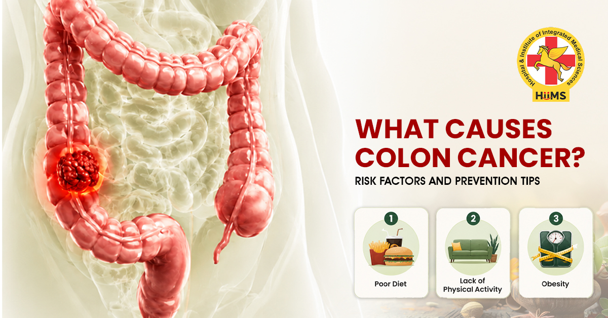 What Causes Colon Cancer Risk Factors and Prevention Tips