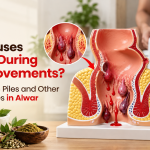 What Causes Bleeding During Bowel Movements? Understanding Piles and Other Possible Causes in Alwar