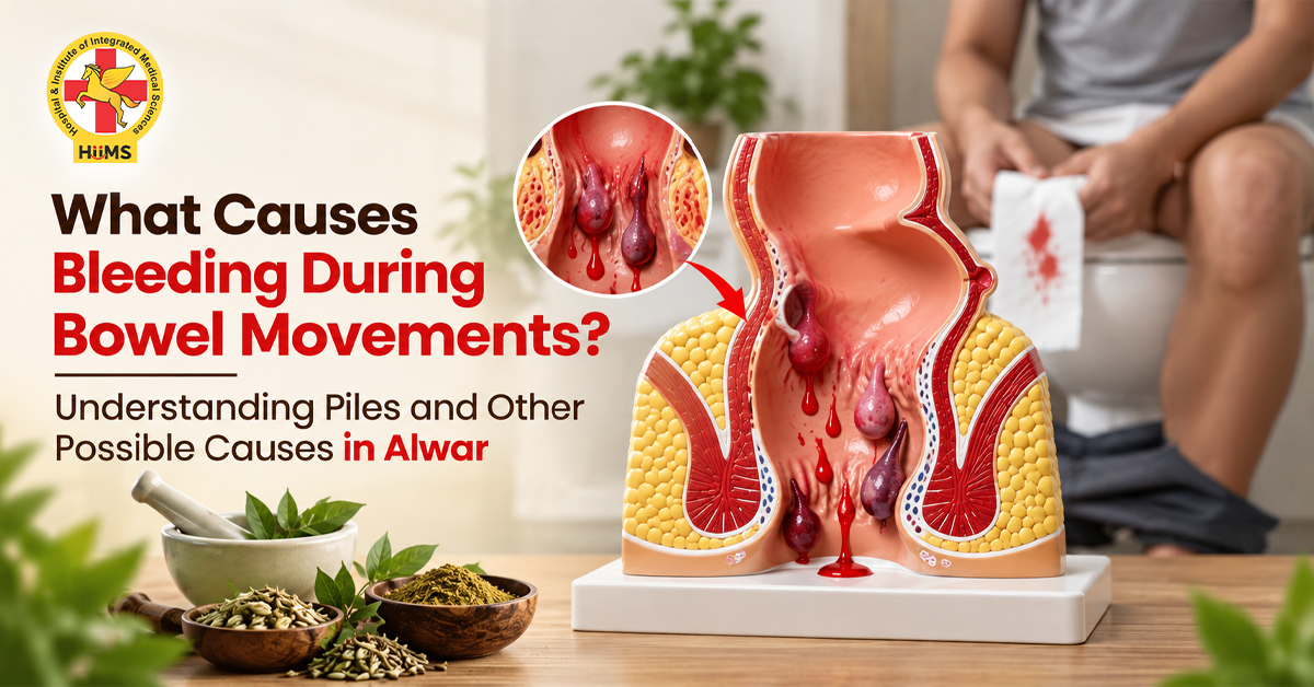 What-Causes-Bleeding-During-Bowel-Movements
