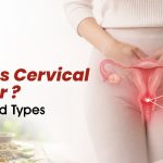 What Is Cervical Cancer? Simple Guide to Basics, Types, and Care