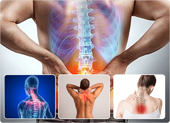 backpain