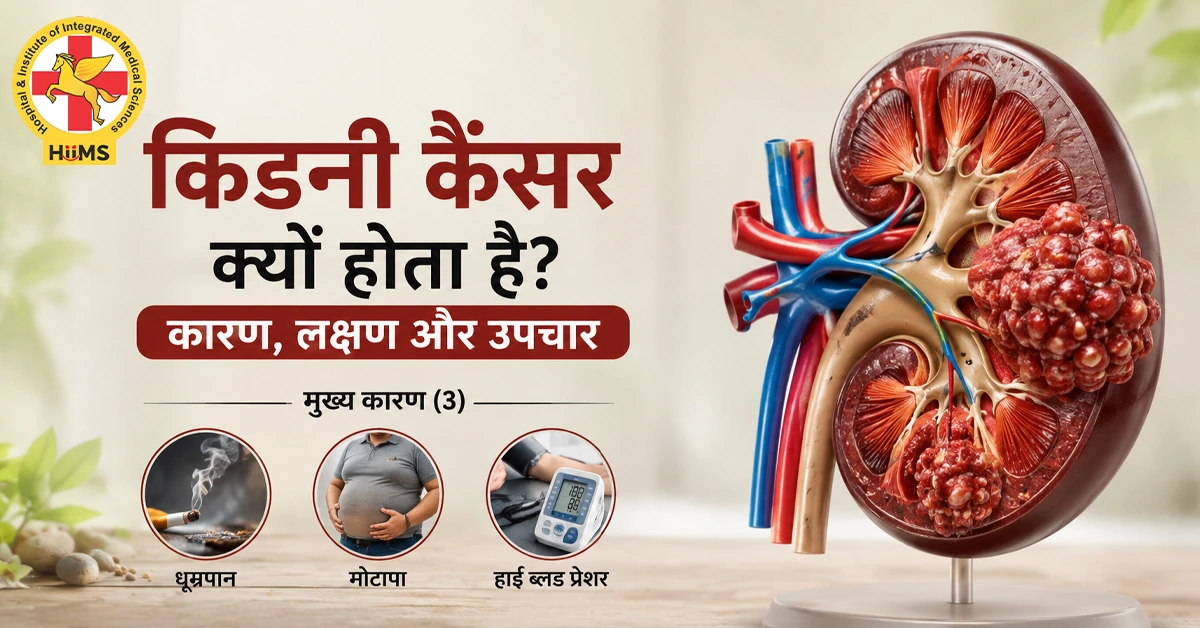 किडनी कैंसर क्यों होता है?