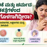 ದಾದ, ತುರಿಕೆ ಮತ್ತು ಚರ್ಮದ ಮೇಲಿನ ಚಕತ್ತೆಗಳಿಂದ ತೊಂದರೆಗೊಳಗಾಗಿದ್ದೀರಾ? Skin Disease ನ ಕಾರಣಗಳು, ಲಕ್ಷಣಗಳು ಮತ್ತು ಚಿಕಿತ್ಸಾ ಆಯ್ಕೆಗಳನ್ನು ತಿಳಿಯಿರಿ