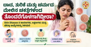 ದಾದ, ತುರಿಕೆ ಮತ್ತು ಚರ್ಮದ ...ಾ ಆಯ್ಕೆಗಳನ್ನು ತಿಳಿಯಿರಿ