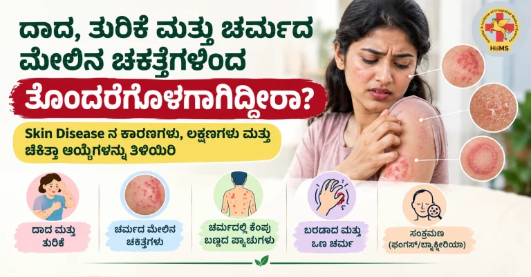 ದಾದ, ತುರಿಕೆ ಮತ್ತು ಚರ್ಮದ ...ಾ ಆಯ್ಕೆಗಳನ್ನು ತಿಳಿಯಿರಿ