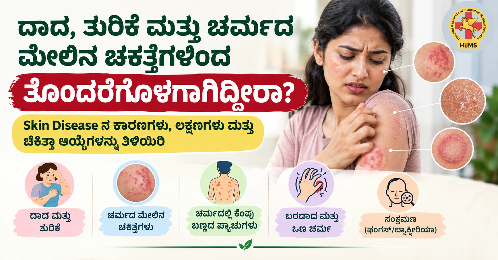 ದಾದ, ತುರಿಕೆ ಮತ್ತು ಚರ್ಮದ ...ಾ ಆಯ್ಕೆಗಳನ್ನು ತಿಳಿಯಿರಿ