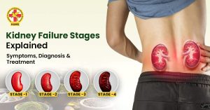 Kidney Failure Stages