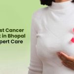 Need Breast Cancer Treatment in Bhopal Choose Expert Care Today