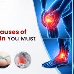 Top 10 Causes of Joint Pain You Must Know