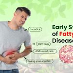 Early Symptoms of Fatty Liver Disease