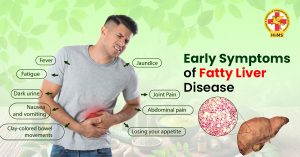 Early Symptoms of Fatty Liver Disease