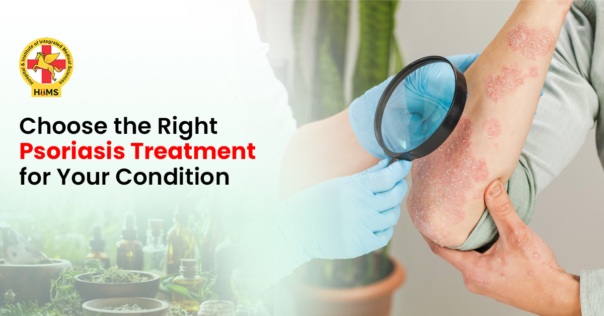 Choose the Right Psoriasis Treatment for Your Condition