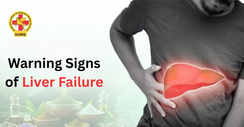Warning Signs of Liver Failure