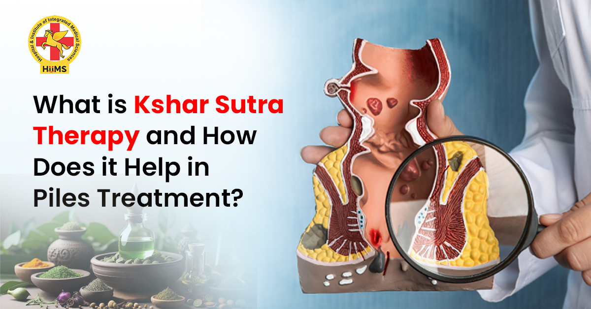 What is Kshar Sutra Therapy and How Does It Help in Piles Treatment