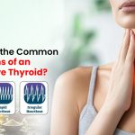 Common Symptoms of an Overactive Thyroid