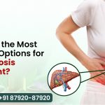What Are the Most Effective Options for Liver Fibrosis Treatment?