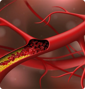 Cholesterol