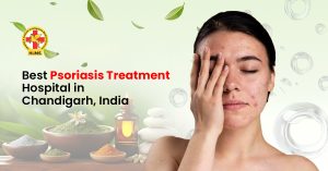 Best Psoriasis Treatment Hospital in Chandigarh,