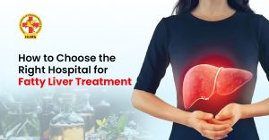 Fatty Liver Treatment