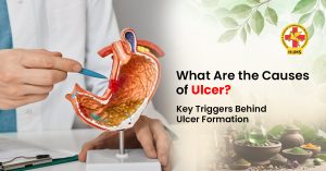 Causes of Ulcers