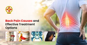 Back Pain Causes and Effective Treatment Options