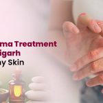 Best Eczema Treatment in Chandigarh for Healthy Skin